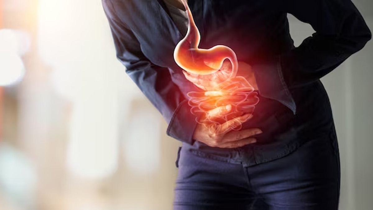 Why Are Young People Becoming More Prone To Colon Cancer?